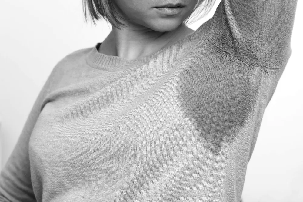Hyperhidrosis Treatment Calgary: Botox for Excessive Sweating